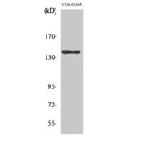 Western Blot - Anti-ADCY5 + ADCY6 Antibody (C12035) - Antibodies.com