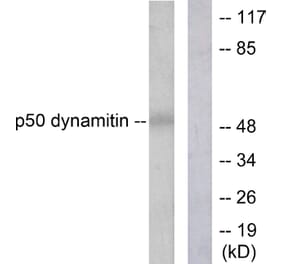Western Blot - Anti-p50 Dynamitin Antibody (C0291) - Antibodies.com
