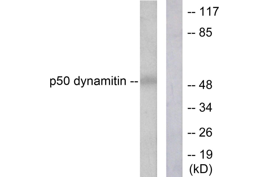 Western Blot - Anti-p50 Dynamitin Antibody (C0291) - Antibodies.com