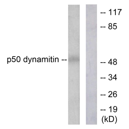 Western Blot - Anti-p50 Dynamitin Antibody (C0291) - Antibodies.com