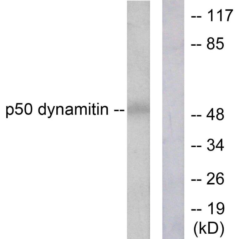 Western Blot - Anti-p50 Dynamitin Antibody (C0291) - Antibodies.com