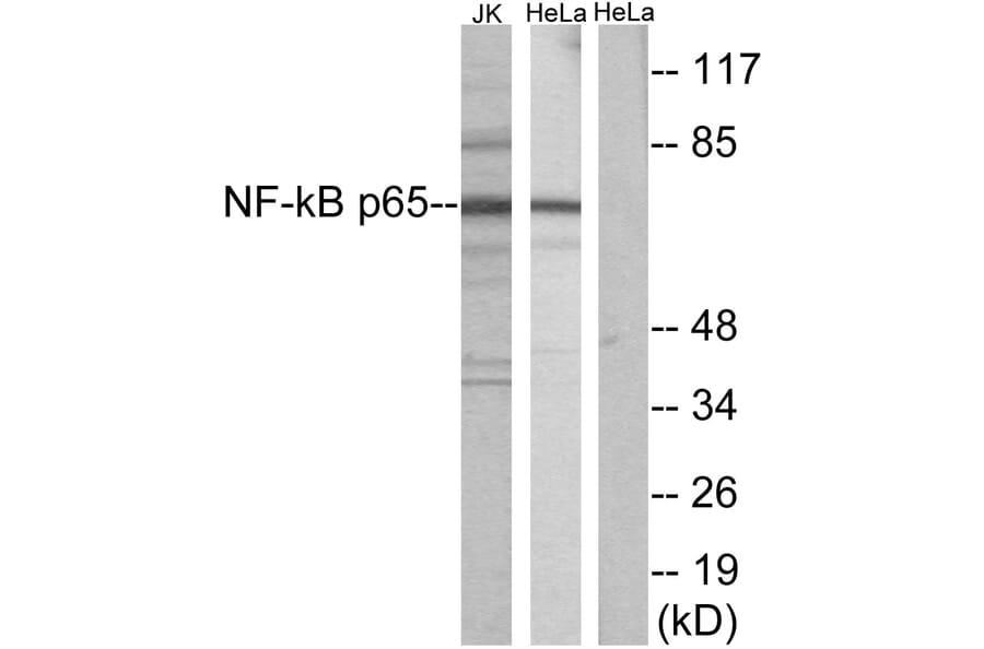 Western Blot - Anti-NF-kappaB p65 Antibody (B7162) - Antibodies.com