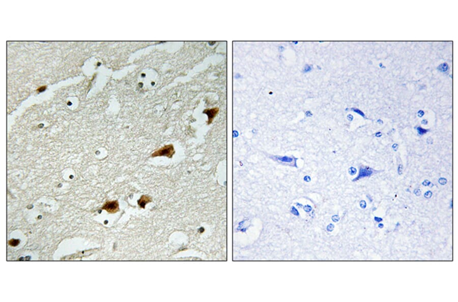 Immunohistochemistry - Anti-NF-kappaB p65 Antibody (B7162) - Antibodies.com