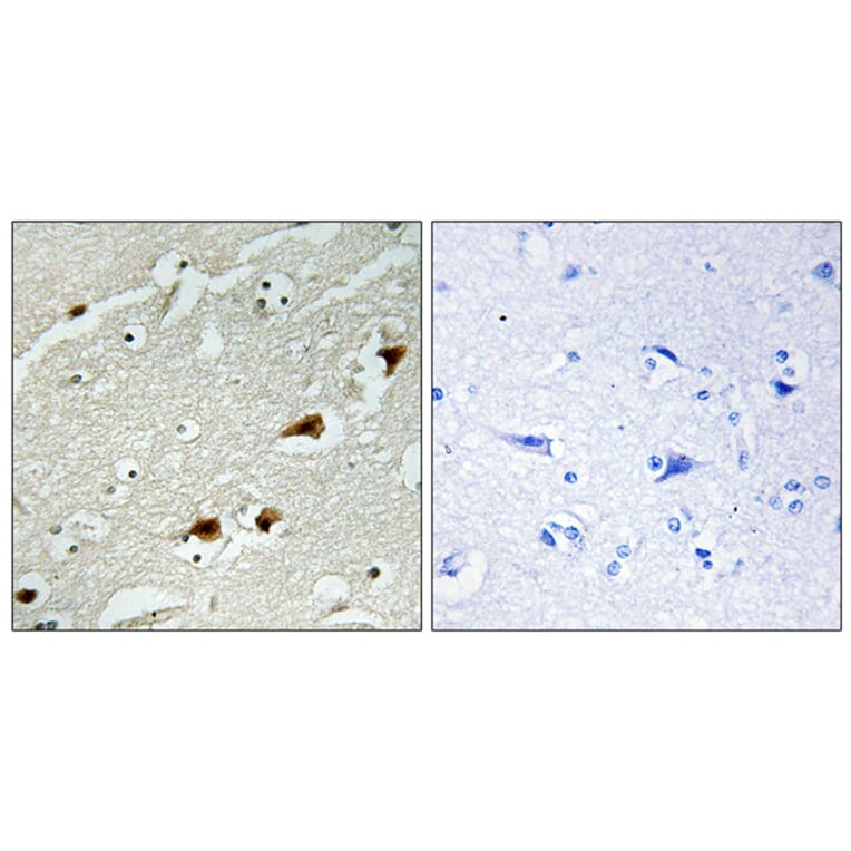 Immunohistochemistry - Anti-NF-kappaB p65 Antibody (B7162) - Antibodies.com