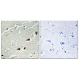 Immunohistochemistry - Anti-NF-kappaB p65 Antibody (B7162) - Antibodies.com