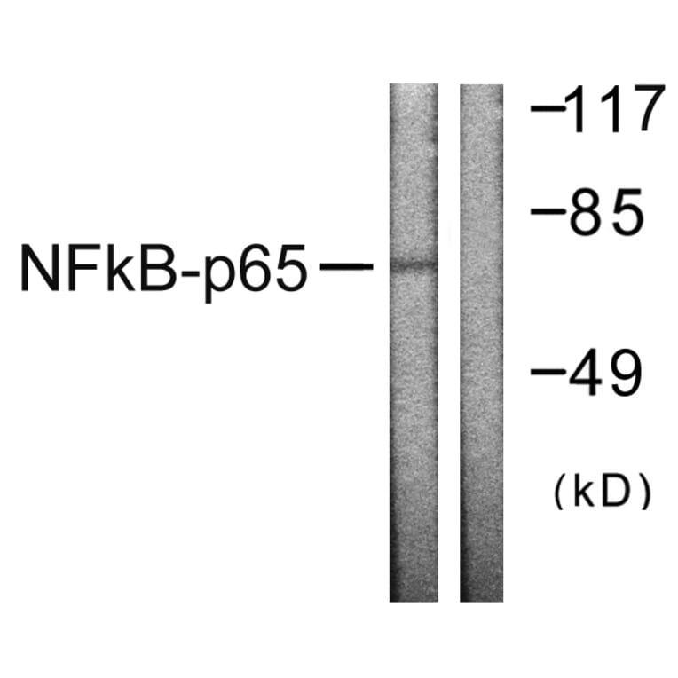 Western Blot - Anti-NF-kappaB p65 Antibody (B0525) - Antibodies.com
