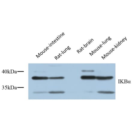 Western Blot - Anti-IkappaB-alpha Antibody (C10481) - Antibodies.com