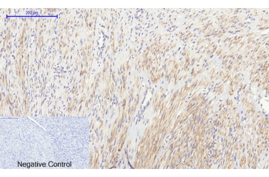 Immunohistochemistry - Anti-IkappaB-alpha Antibody (C10481) - Antibodies.com