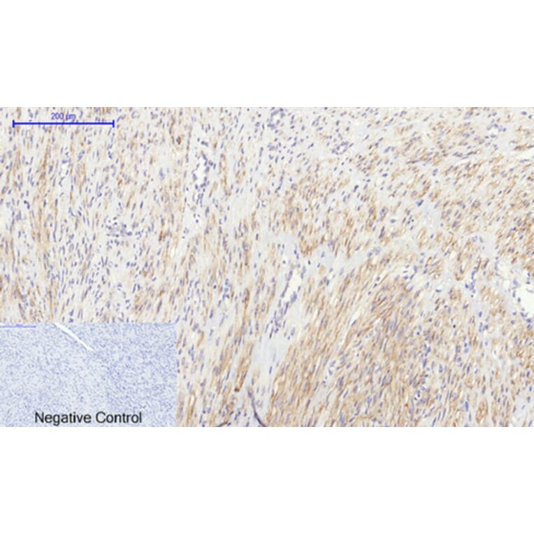 Immunohistochemistry - Anti-IkappaB-alpha Antibody (C10481) - Antibodies.com