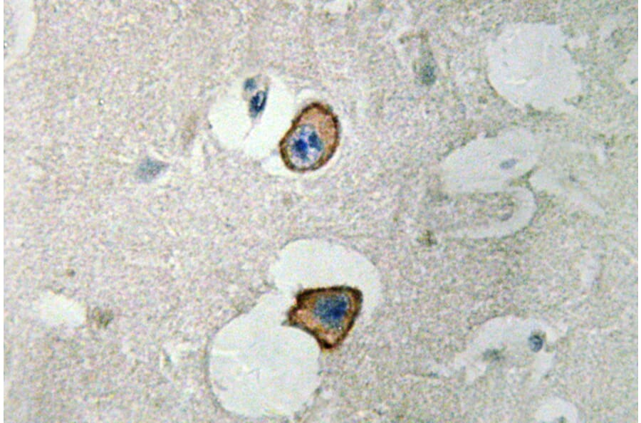 Immunohistochemistry - Anti-NMDAepsilon4 Antibody (R12-2269) - Antibodies.com
