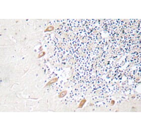 Immunohistochemistry - Anti-GABAA Rbeta2 Antibody (R12-2152) - Antibodies.com