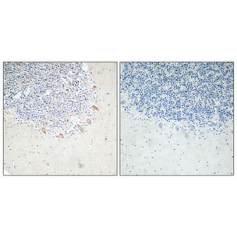 Immunohistochemistry - Anti-GABAA Rbeta2 Antibody (R12-2152) - Antibodies.com