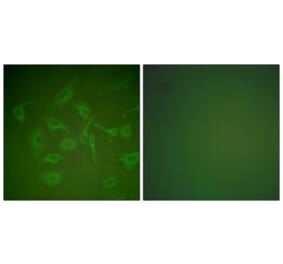 Immunofluorescence - Anti-Mammaglobin Antibody (C0255) - Antibodies.com