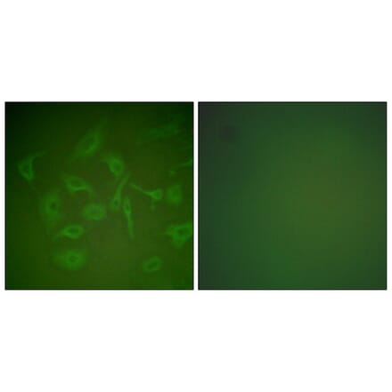 Immunofluorescence - Anti-Mammaglobin Antibody (C0255) - Antibodies.com