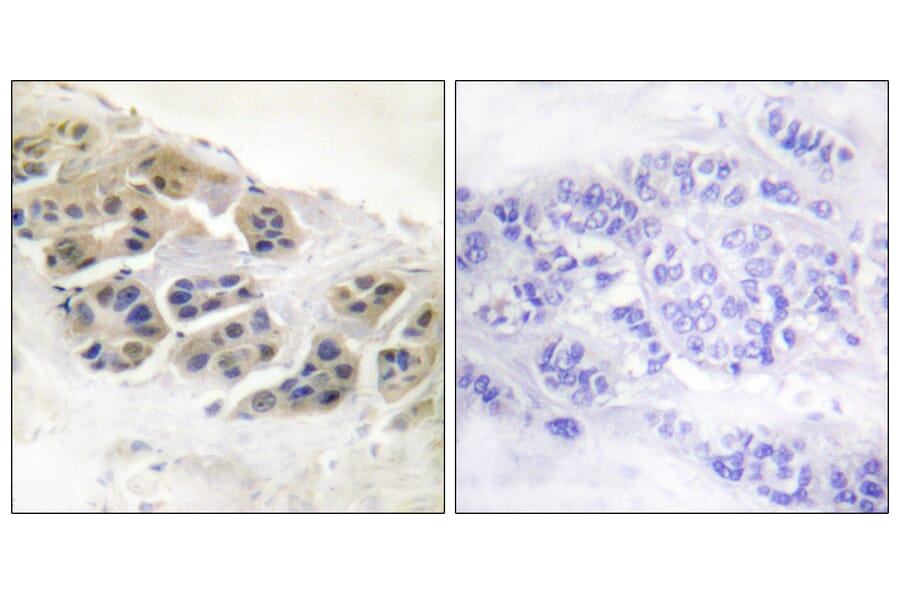 Immunohistochemistry - Anti-Mammaglobin Antibody (C0255) - Antibodies.com