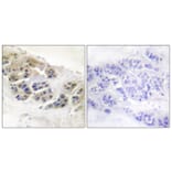 Immunohistochemistry - Anti-Mammaglobin Antibody (C0255) - Antibodies.com
