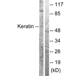 Western Blot - Anti-Keratin 8 Antibody (B0017) - Antibodies.com