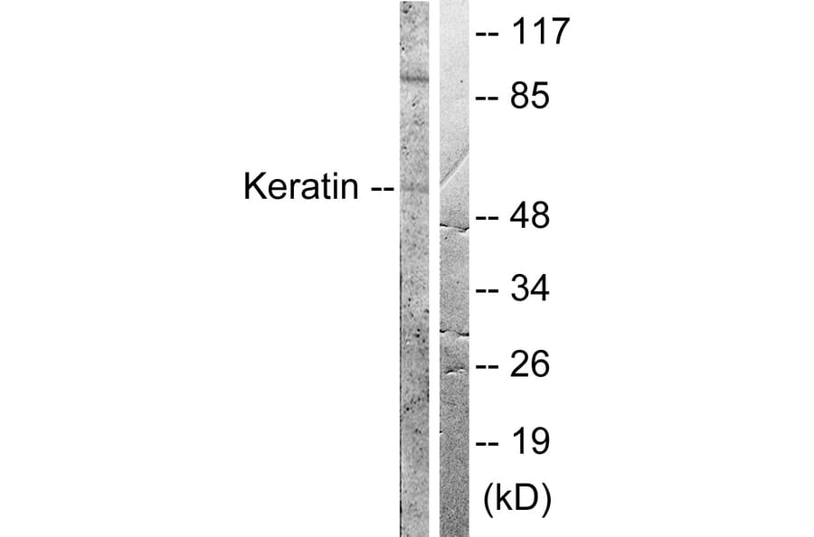 Western Blot - Anti-Keratin 8 Antibody (B0017) - Antibodies.com
