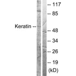 Western Blot - Anti-Keratin 8 Antibody (B0017) - Antibodies.com
