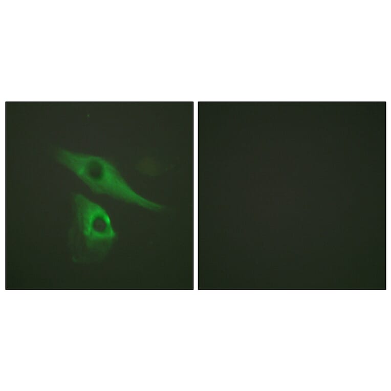 Immunofluorescence - Anti-Keratin 8 Antibody (B0017) - Antibodies.com