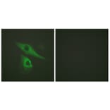 Immunofluorescence - Anti-Keratin 8 Antibody (B0017) - Antibodies.com