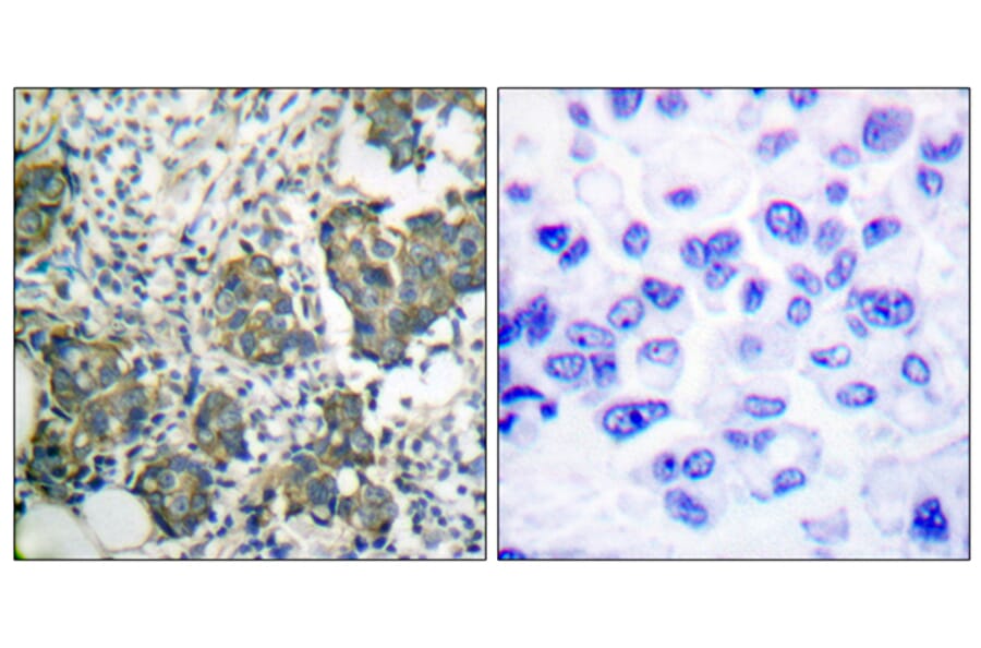 Immunohistochemistry - Anti-Keratin 8 Antibody (B0017) - Antibodies.com
