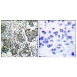 Immunohistochemistry - Anti-Keratin 8 Antibody (B0017) - Antibodies.com