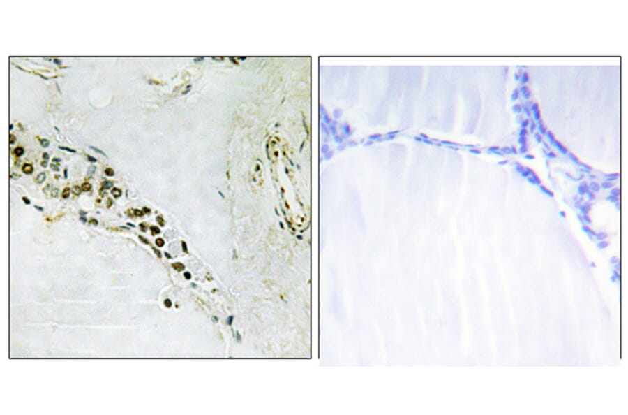 Immunohistochemistry - Anti-Cyclin E2 Antibody (B0880) - Antibodies.com