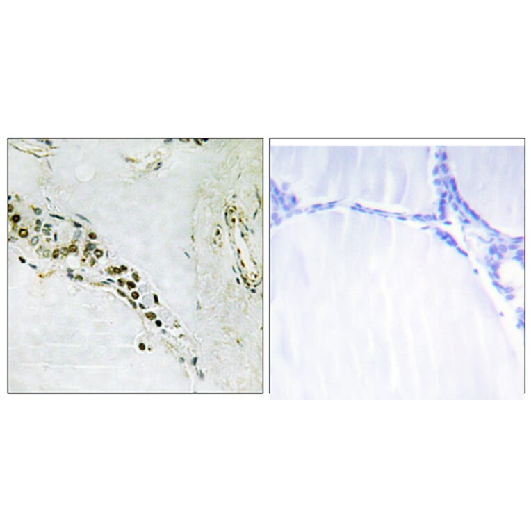 Immunohistochemistry - Anti-Cyclin E2 Antibody (B0880) - Antibodies.com