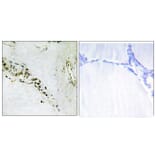 Immunohistochemistry - Anti-Cyclin E2 Antibody (B0880) - Antibodies.com