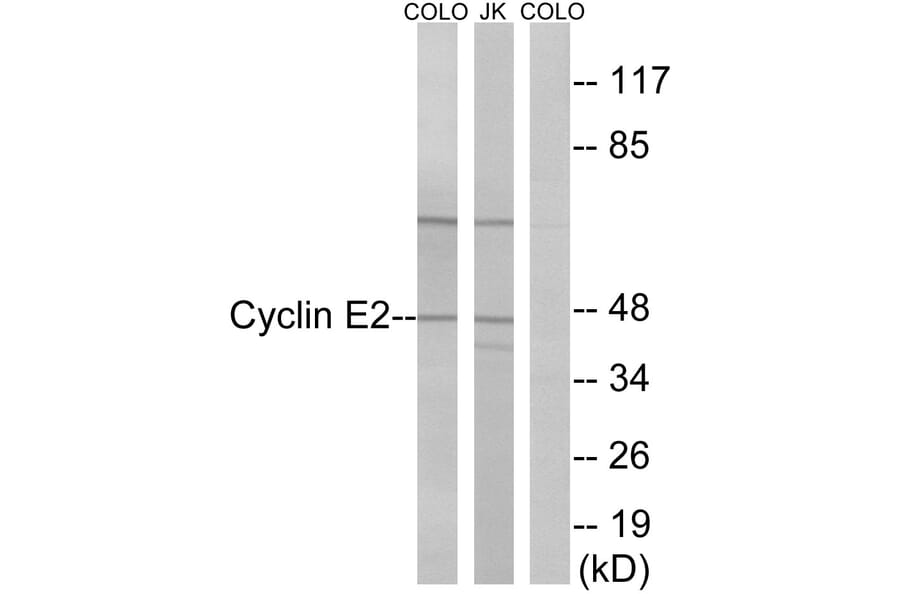 Western Blot - Anti-Cyclin E2 Antibody (B0880) - Antibodies.com