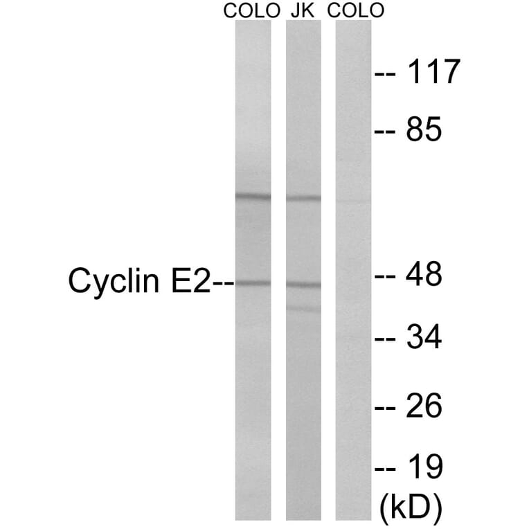 Western Blot - Anti-Cyclin E2 Antibody (B0880) - Antibodies.com
