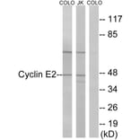 Western Blot - Anti-Cyclin E2 Antibody (B0880) - Antibodies.com