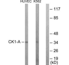 Western Blot - Anti-CKI-alpha Antibody (B1194) - Antibodies.com