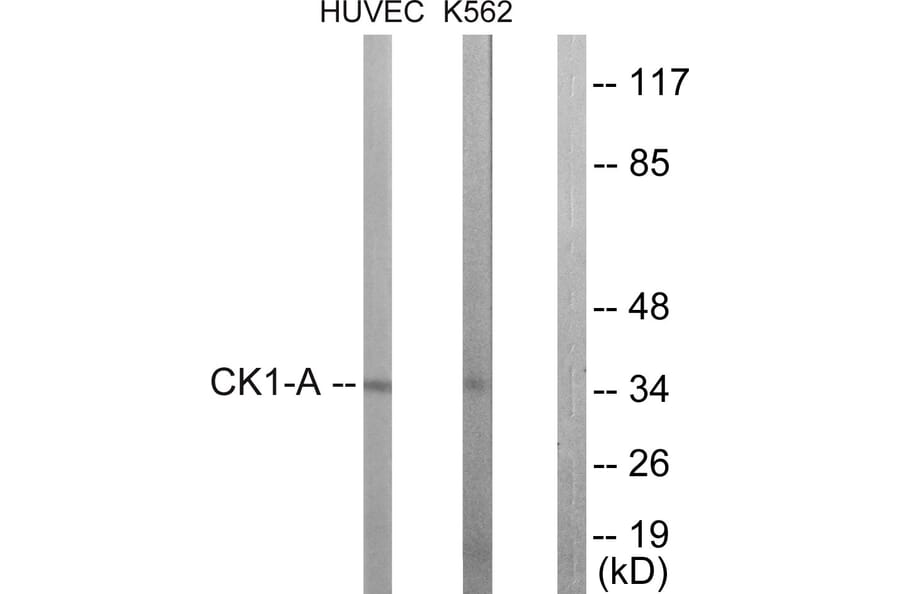Western Blot - Anti-CKI-alpha Antibody (B1194) - Antibodies.com