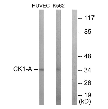 Western Blot - Anti-CKI-alpha Antibody (B1194) - Antibodies.com