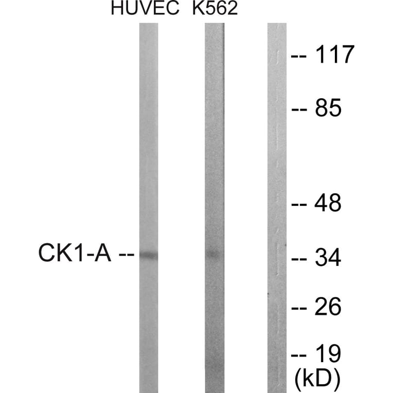 Western Blot - Anti-CKI-alpha Antibody (B1194) - Antibodies.com