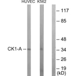 Western Blot - Anti-CKI-alpha Antibody (B1194) - Antibodies.com