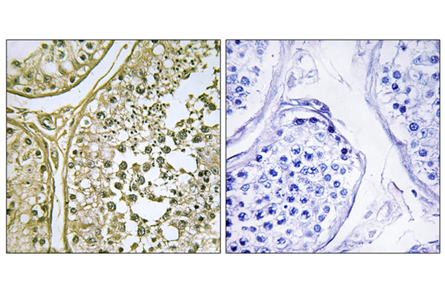 Immunohistochemistry - Anti-CSNK1A1L Antibody (C11354) - Antibodies.com