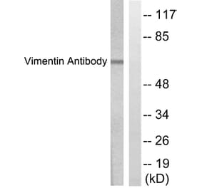 Western Blot - Anti-Vimentin Antibody (C0390) - Antibodies.com