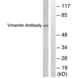 Western Blot - Anti-Vimentin Antibody (C0390) - Antibodies.com