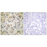 Immunohistochemistry - Anti-Vimentin Antibody (C0390) - Antibodies.com