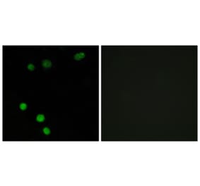 Immunofluorescence - Anti-TP53INP2 Antibody (C11320) - Antibodies.com