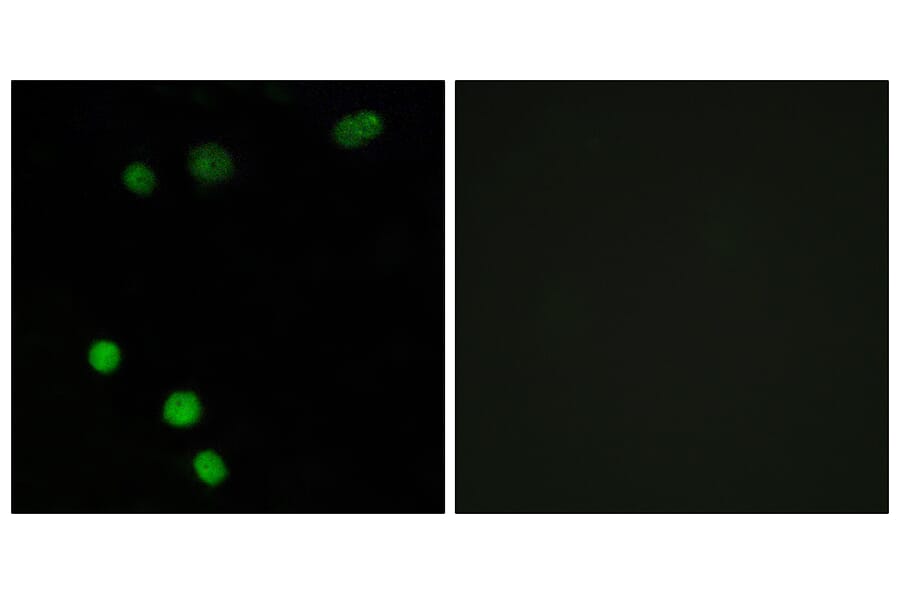 Immunofluorescence - Anti-TP53INP2 Antibody (C11320) - Antibodies.com