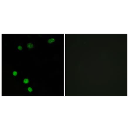 Immunofluorescence - Anti-TP53INP2 Antibody (C11320) - Antibodies.com