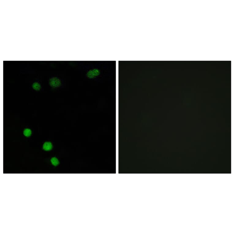 Immunofluorescence - Anti-TP53INP2 Antibody (C11320) - Antibodies.com
