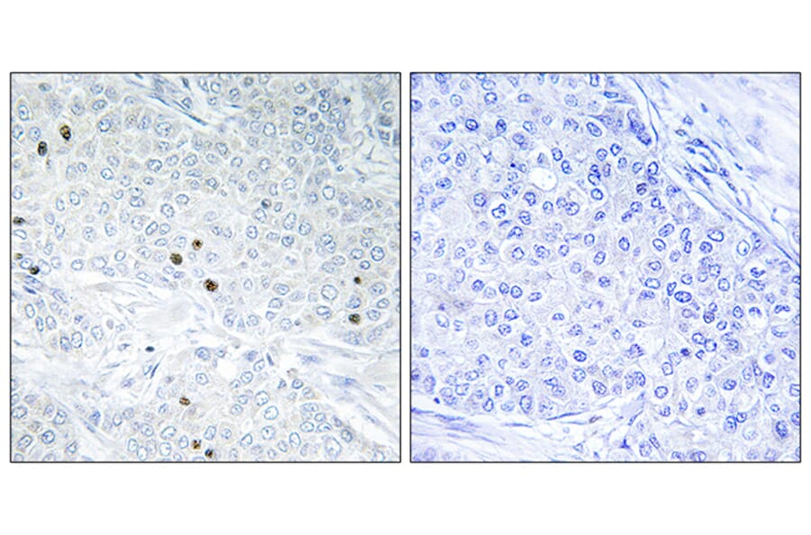 Immunohistochemistry - Anti-TP53INP2 Antibody (C11320) - Antibodies.com