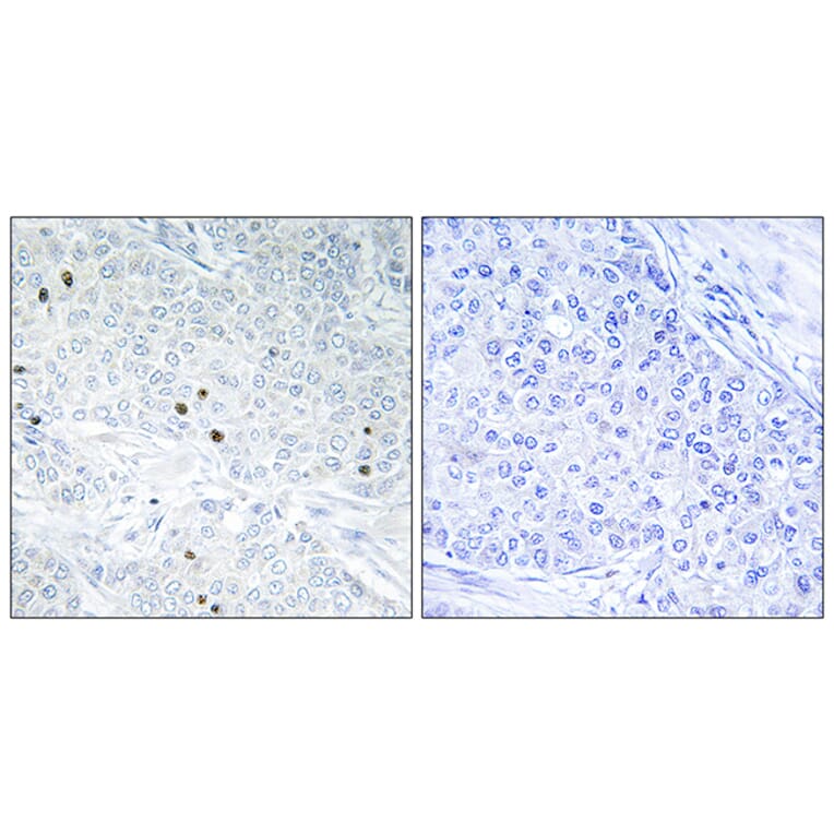 Immunohistochemistry - Anti-TP53INP2 Antibody (C11320) - Antibodies.com