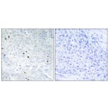 Immunohistochemistry - Anti-TP53INP2 Antibody (C11320) - Antibodies.com