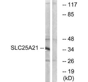 Western Blot - Anti-SLC25A21 Antibody (C16666) - Antibodies.com